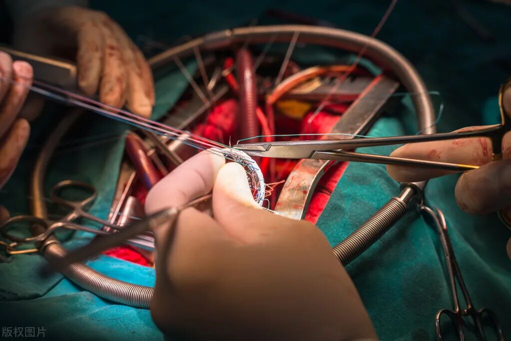 缝合线怎么消毒【规培指导】关于急诊清创缝合术必须掌握知识_https://www.jmylbn.com_新闻资讯_第2张