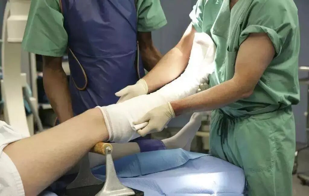 医用石膏夹板怎么软化关于骨折石膏固定技术总结及注意事项_https://www.jmylbn.com_新闻资讯_第2张