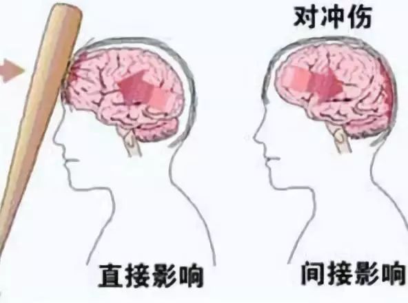 上肢夹板怎么用干货：临床常见各种创伤急救措施_https://www.jmylbn.com_新闻资讯_第27张