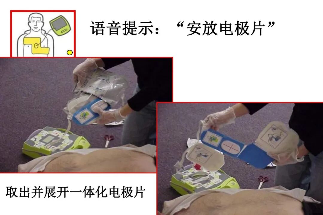 什么是aed除颤【急救科普】自动体外除颤器（AED）使用及注意事项_https://www.jmylbn.com_新闻资讯_第28张