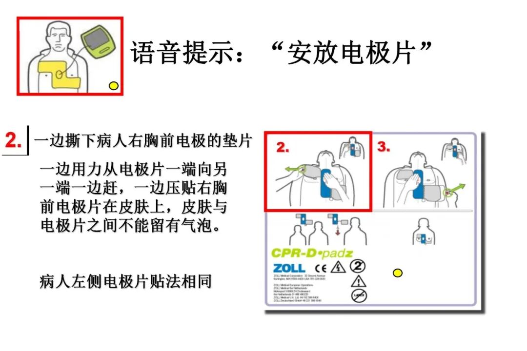 什么是aed除颤【急救科普】自动体外除颤器（AED）使用及注意事项_https://www.jmylbn.com_新闻资讯_第31张