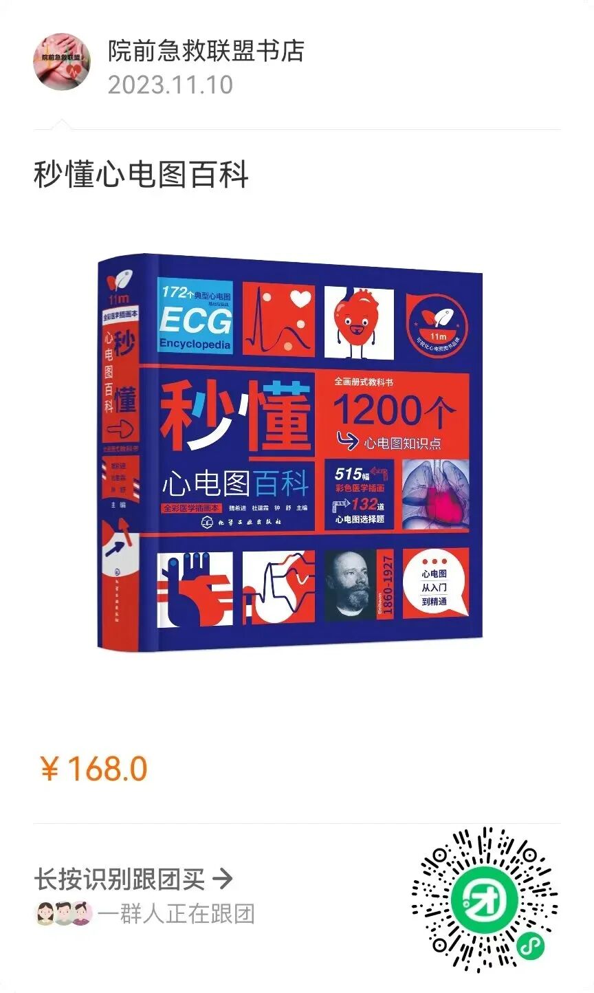 心电图机通道怎么分类心律失常——室性早搏的诊疗_https://www.jmylbn.com_新闻资讯_第13张