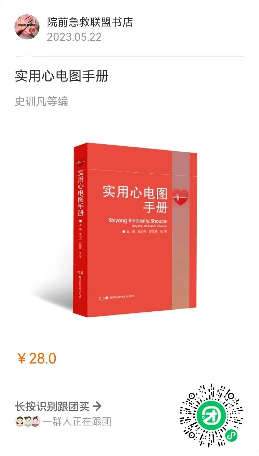 心电图机通道怎么分类心律失常——室性早搏的诊疗_https://www.jmylbn.com_新闻资讯_第12张