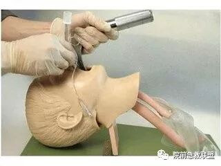 插管固定怎么安装气管插管操作流程及护理要点（附操作录相）_https://www.jmylbn.com_新闻资讯_第1张