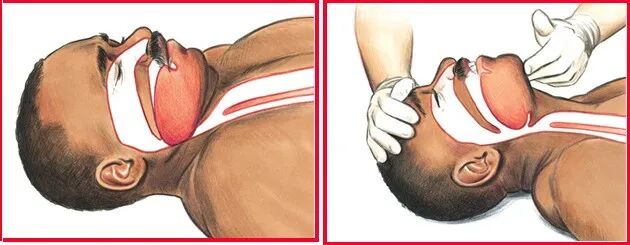 cpr按压板怎么用心肺复苏术的操作方法_https://www.jmylbn.com_新闻资讯_第7张
