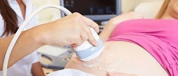 4个的原因男翻女_男翻女可能性_为什么说男翻女几率大