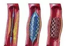 dsa是什么设备【影像中心全景之DR／DSA专栏】人员、设备简介及DR／DSA技术成果展示_https://www.jmylbn.com_新闻资讯_第33张