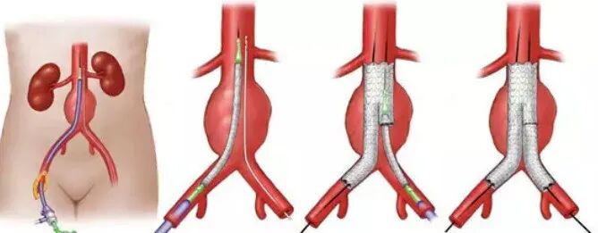 dsa是什么设备【影像中心全景之DR／DSA专栏】人员、设备简介及DR／DSA技术成果展示_https://www.jmylbn.com_新闻资讯_第35张