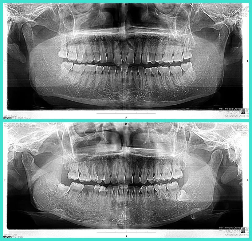 dsa是什么设备【影像中心全景之DR／DSA专栏】人员、设备简介及DR／DSA技术成果展示_https://www.jmylbn.com_新闻资讯_第22张