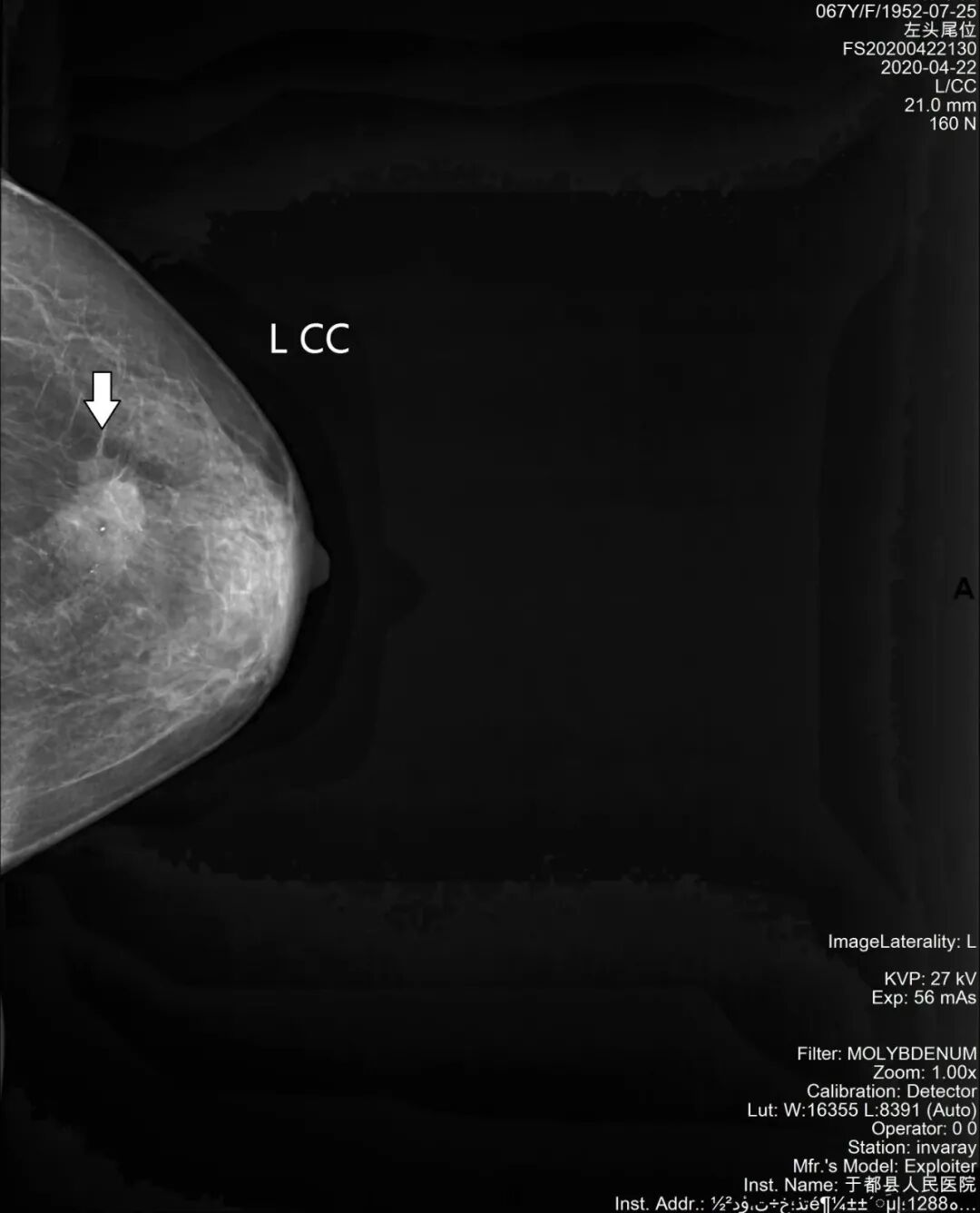 dsa是什么设备【影像中心全景之DR／DSA专栏】人员、设备简介及DR／DSA技术成果展示_https://www.jmylbn.com_新闻资讯_第18张