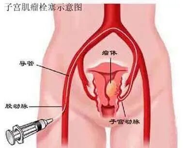 dsa是什么设备【影像中心全景之DR／DSA专栏】人员、设备简介及DR／DSA技术成果展示_https://www.jmylbn.com_新闻资讯_第31张