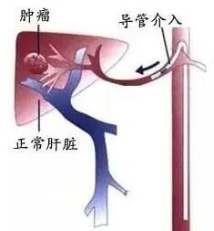 dsa是什么设备【影像中心全景之DR／DSA专栏】人员、设备简介及DR／DSA技术成果展示_https://www.jmylbn.com_新闻资讯_第29张