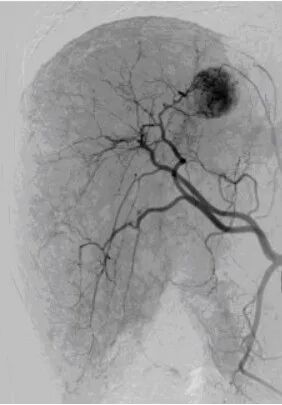 dsa是什么设备【影像中心全景之DR／DSA专栏】人员、设备简介及DR／DSA技术成果展示_https://www.jmylbn.com_新闻资讯_第37张