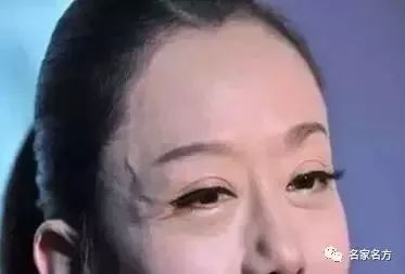 手上青筋越多，說明越…尤其是女性，一定要看！ 健康 第5張