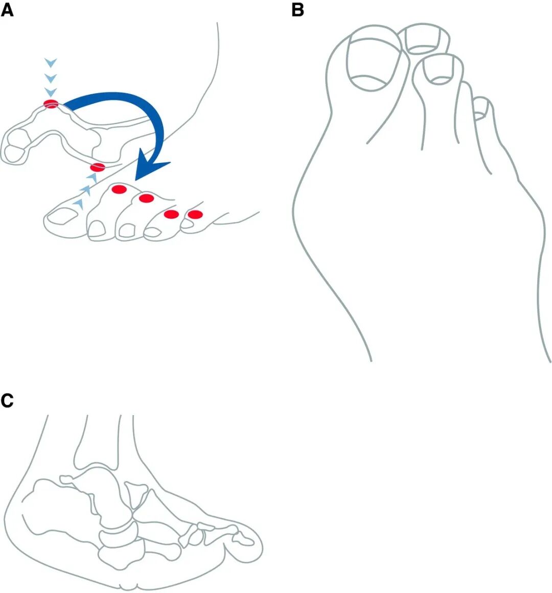 为什么糖尿病不能震动糖尿病足专科检查_https://www.jmylbn.com_新闻资讯_第4张