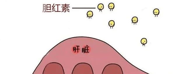 cover_image