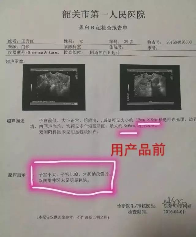 身心靈健康~寧密康子宮肌瘤調理案例 - 1985790939的主頁