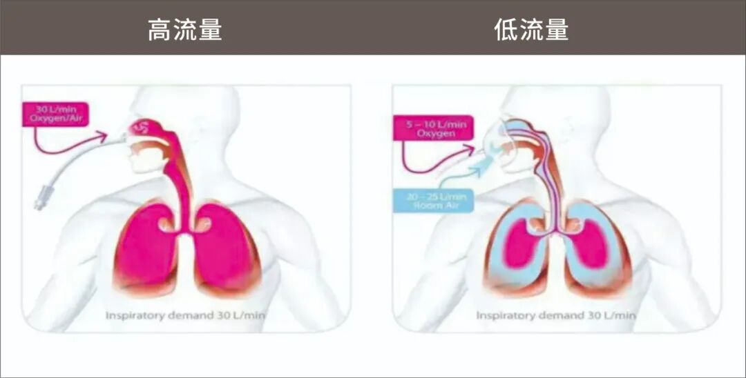吸氧湿化用什么氧疗与气道湿化_https://www.jmylbn.com_新闻资讯_第5张