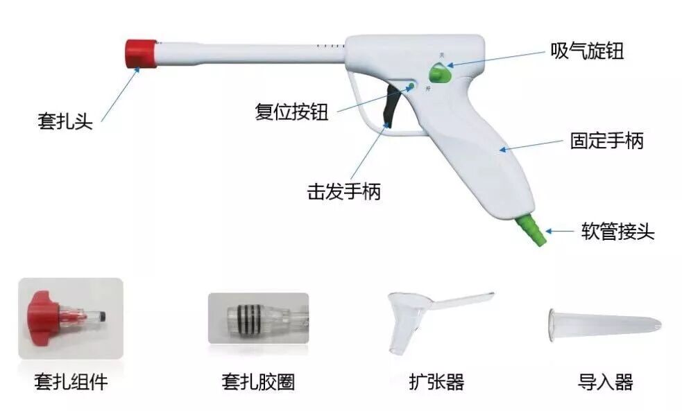 套扎器怎么用无锡东峰怡和 一次性使用肛肠套扎器使用简介_https://www.jmylbn.com_新闻资讯_第11张