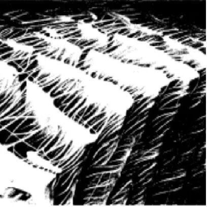 明胶在血管怎么降解泰尔茂人工血管——人工血管基础知识_https://www.jmylbn.com_新闻资讯_第9张