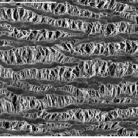 明胶在血管怎么降解泰尔茂人工血管——人工血管基础知识_https://www.jmylbn.com_新闻资讯_第10张