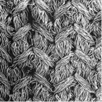 明胶在血管怎么降解泰尔茂人工血管——人工血管基础知识_https://www.jmylbn.com_新闻资讯_第7张