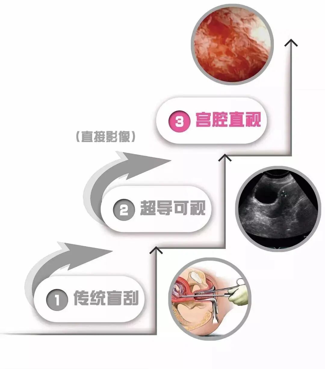 人流吸引管怎么选择爱康医院人流手术‖全程呵护子宫，全面护理，让你恢复如初_https://www.jmylbn.com_新闻资讯_第2张