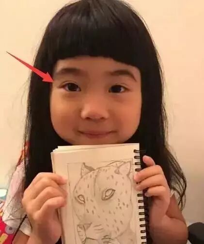 7岁的曹格女儿从肿泡眼变双眼皮,小小年纪真做手术了?