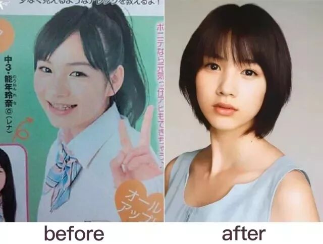 眼睛短小 眼距宽 你与电眼女神只差一个开眼角 重庆华美整形医院 微信公众号文章阅读 Wemp