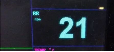 监护仪上的数据怎么看医院陪护中，学会看心电监护仪数据，开始学习吧！_https://www.jmylbn.com_新闻资讯_第4张