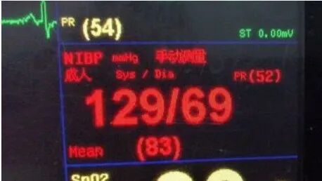 监护仪上的数据怎么看医院陪护中，学会看心电监护仪数据，开始学习吧！_https://www.jmylbn.com_新闻资讯_第5张