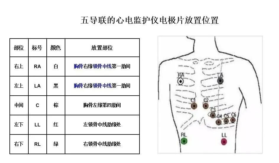 监护仪上的数据怎么看医院陪护中，学会看心电监护仪数据，开始学习吧！_https://www.jmylbn.com_新闻资讯_第8张