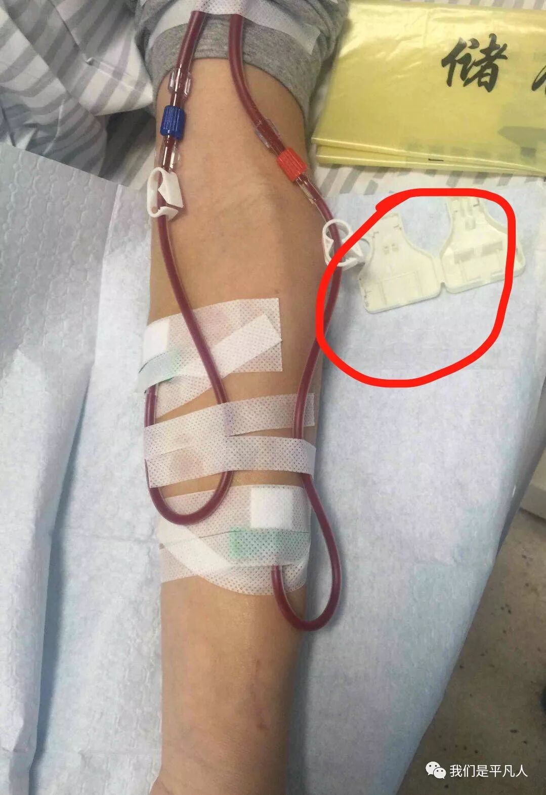 穿刺针怎么用透析护士｜使用后的透析用穿刺针，应如何处理呢？_https://www.jmylbn.com_新闻资讯_第9张