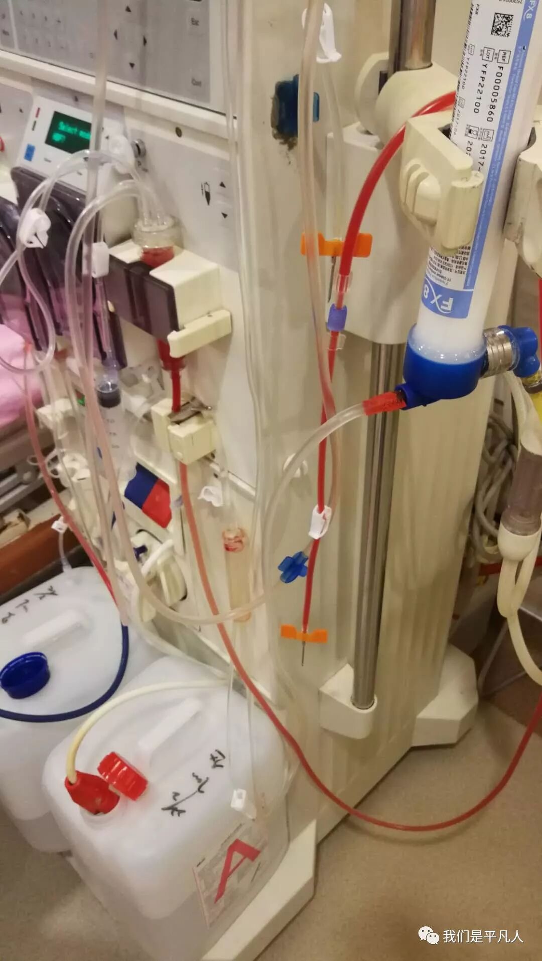 穿刺针怎么用透析护士｜使用后的透析用穿刺针，应如何处理呢？_https://www.jmylbn.com_新闻资讯_第18张