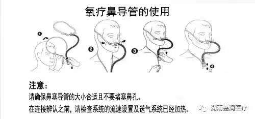 吸氧应该什么浓度鼻导管吸氧时的氧浓度（FiO2）计算公式_https://www.jmylbn.com_新闻资讯_第11张