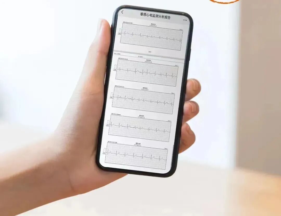 心电图检测仪怎么用【索思科研一线】可穿戴式实时心电监测仪与传统动态心电图在日常居家监测时的对比研究_https://www.jmylbn.com_新闻资讯_第9张