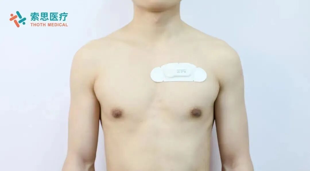 心电图检测仪怎么用【索思科研一线】可穿戴式实时心电监测仪与传统动态心电图在日常居家监测时的对比研究_https://www.jmylbn.com_新闻资讯_第4张