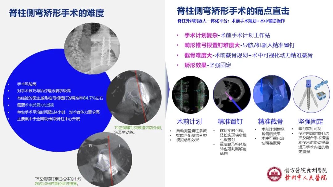 《脊智领航》|