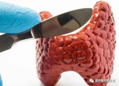 甲亢脖子和正常脖子图片_甲亢突眼正常图片_女性甲亢早期脖子两侧图片