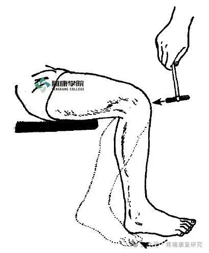 叩诊锤的怎么用康复必备：41个常见的神经反射检查_https://www.jmylbn.com_新闻资讯_第19张