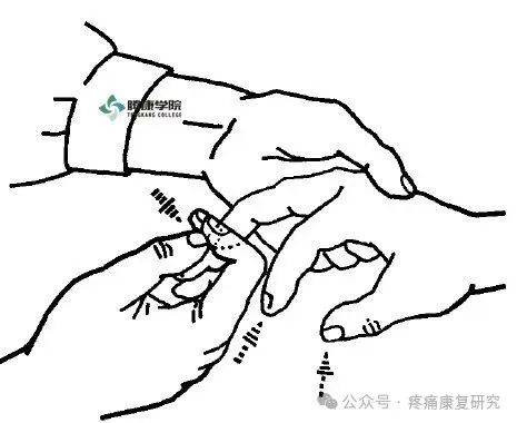 叩诊锤的怎么用康复必备：41个常见的神经反射检查_https://www.jmylbn.com_新闻资讯_第29张