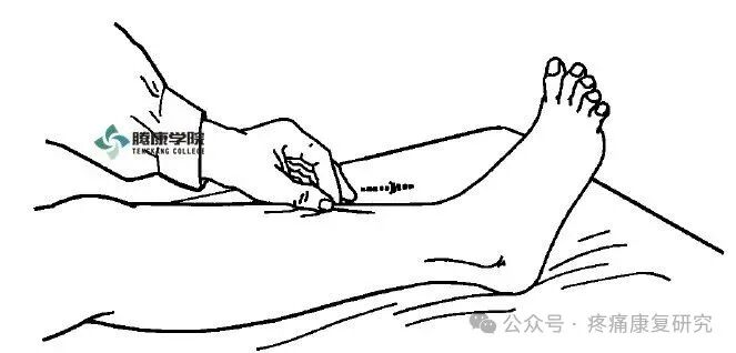 叩诊锤的怎么用康复必备：41个常见的神经反射检查_https://www.jmylbn.com_新闻资讯_第36张