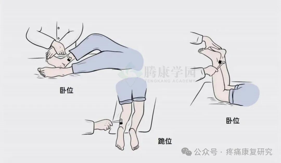 叩诊锤的怎么用康复必备：41个常见的神经反射检查_https://www.jmylbn.com_新闻资讯_第12张