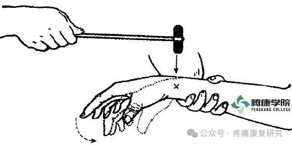 叩诊锤的怎么用康复必备：41个常见的神经反射检查_https://www.jmylbn.com_新闻资讯_第17张
