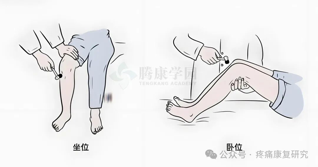 叩诊锤的怎么用康复必备：41个常见的神经反射检查_https://www.jmylbn.com_新闻资讯_第9张