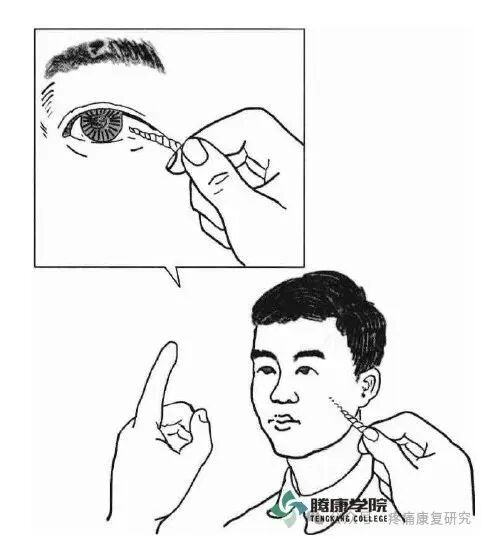 叩诊锤的怎么用康复必备：41个常见的神经反射检查_https://www.jmylbn.com_新闻资讯_第21张