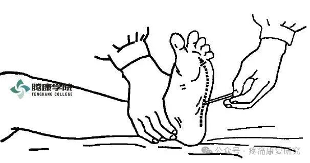 叩诊锤的怎么用康复必备：41个常见的神经反射检查_https://www.jmylbn.com_新闻资讯_第34张