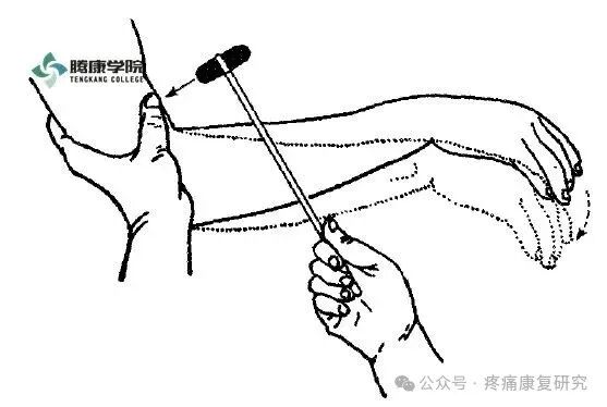叩诊锤的怎么用康复必备：41个常见的神经反射检查_https://www.jmylbn.com_新闻资讯_第15张
