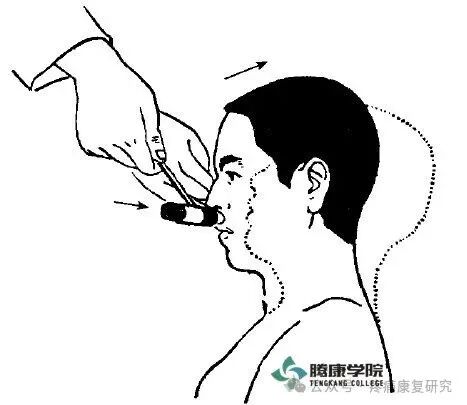 叩诊锤的怎么用康复必备：41个常见的神经反射检查_https://www.jmylbn.com_新闻资讯_第3张