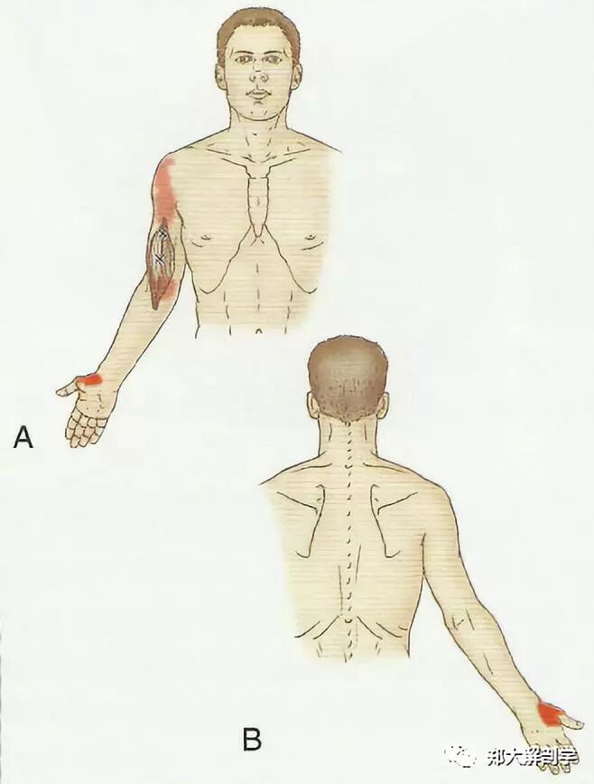 肱桡肌_喙肱肌_肱二头肌和肱肌